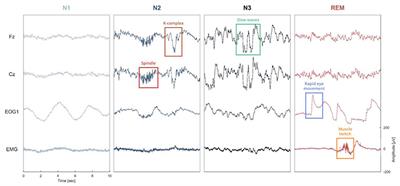 Sleep: An Open-Source Python Software for Visualization, Analysis, and Staging of Sleep Data